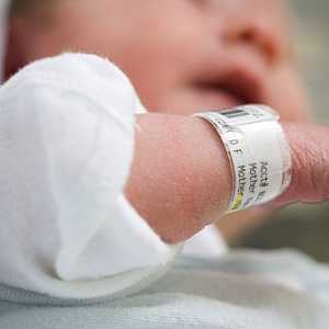 Причини за лющене на кожата при новороденото и как да се реши проблема
