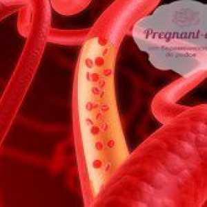 Проблеми с плацентата и матката притока на кръв