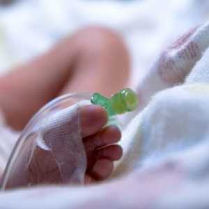 Ранното раждане или какво да правя, ако бебето е родено преждевременно?