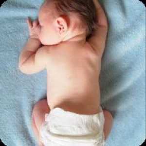 Белене на кожата на новороденото
