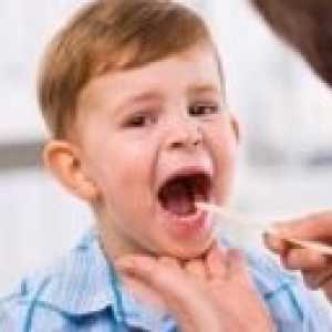 Симптомите на фарингит при децата
