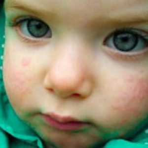 Обрив по лицето на новороденото - идентифициране на причините за