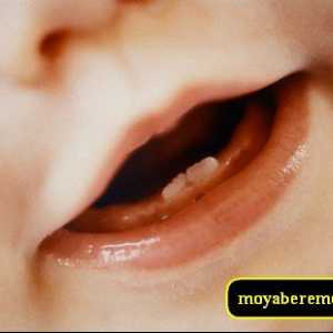 Температура никнене на млечни зъби