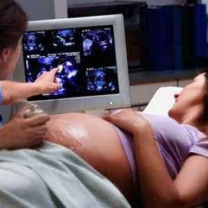 Третият ултразвук по време на бременност