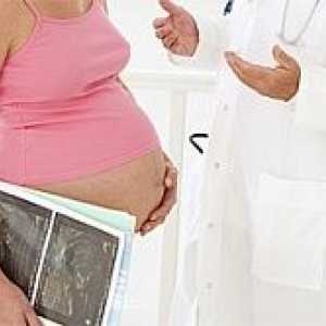 Тромбофилия и бременност