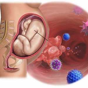 Вътрематочната инфекция по време на бременност и новороденото