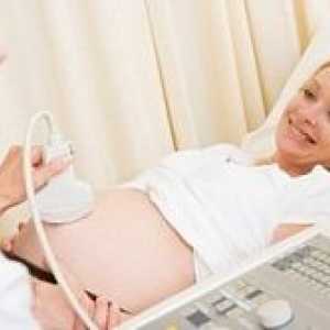Има ли ултразвук е вредно по време на бременност