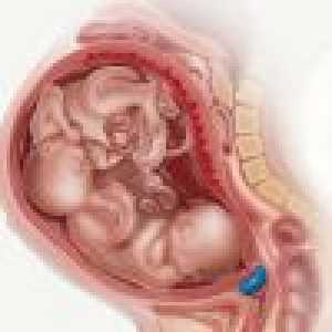 Болести по време на бременност