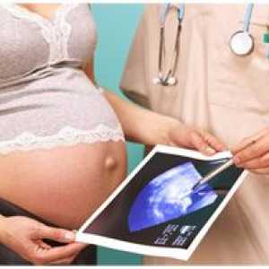 Падежът на плацентата по време на бременност