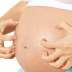 Сърбежът по време на бременност